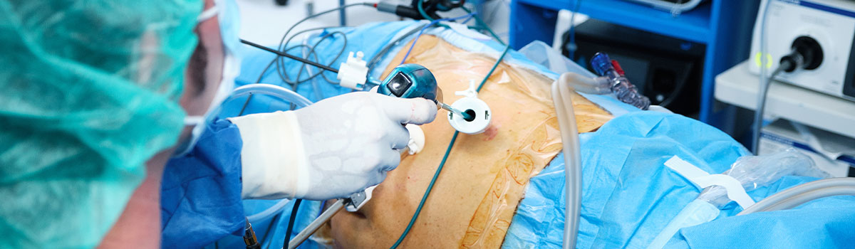 Laparoscopy